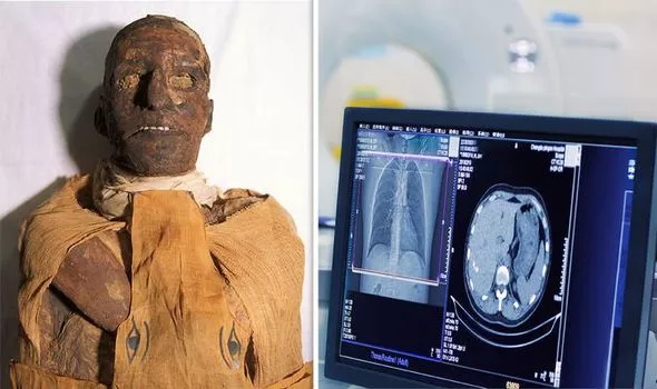 Ramses-III-body-was-scanned-by-scientists-1169343