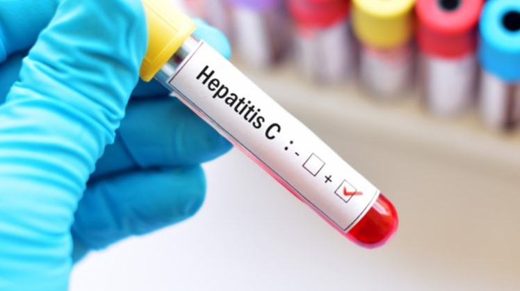 Up to 15.000 Chadian people were checked as part of the Egyptian Initiative to cure one million African from Hepatitis C since the implementation of the initiative last October