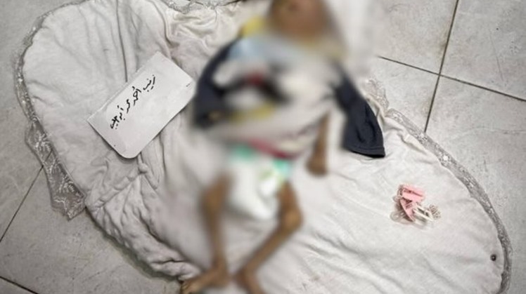  Zeinab, an infant killed by starvation to death policy by Israeli forces in Gaza Strip